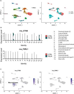 Cathepsin S and Protease-Activated Receptor-2 Drive Alloimmunity and Immune Regulation in Kidney Allograft Rejection